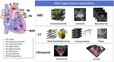 Deep Learning for Cardiac Image Segmentation: A Review